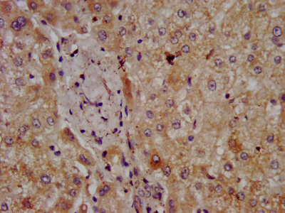 Immunohistochemistry (Formalin/PFA-fixed paraffin-embedded sections) - Anti-CPOX antibody (AB236613)