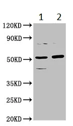 Western blot - Anti-CPOX antibody (AB236613)