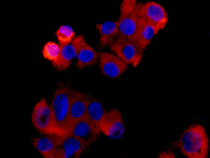 Immunocytochemistry/ Immunofluorescence - Anti-CPOX antibody [EPR11926(B)] (AB170945)