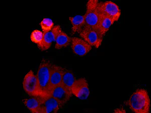Immunocytochemistry/ Immunofluorescence - Anti-CPOX antibody [EPR11926(B)] (AB170945)