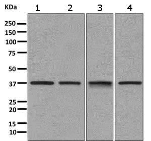 Western blot - Anti-CPOX antibody [EPR11926(B)] (AB170945)