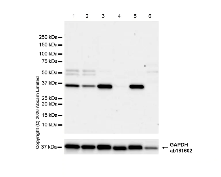 Western blot - Anti-CPOX antibody [EPR11927(B)] (AB169766)