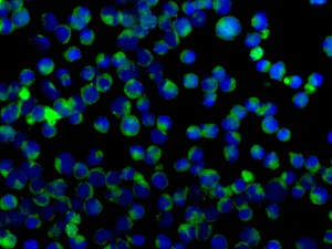 Immunocytochemistry/ Immunofluorescence - Anti-CPOX antibody [EPR11927(B)] - BSA and Azide free (AB249513)