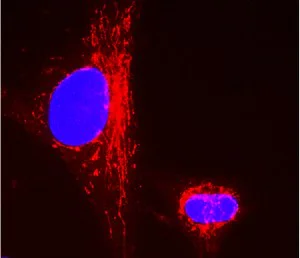 Immunocytochemistry - Anti-CPS1 antibody [2E4AE11] (AB110303)