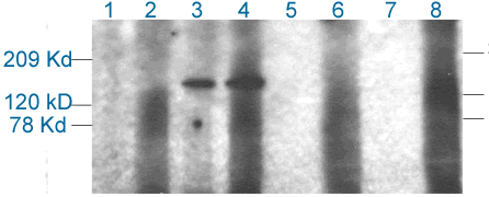 Western blot - Anti-CPS1 antibody (AB3682)