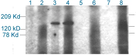 Western blot - Anti-CPS1 antibody (AB3682)