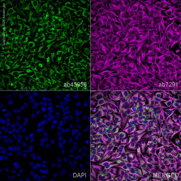 Immunocytochemistry/ Immunofluorescence - Anti-CPS1 antibody (AB45956)