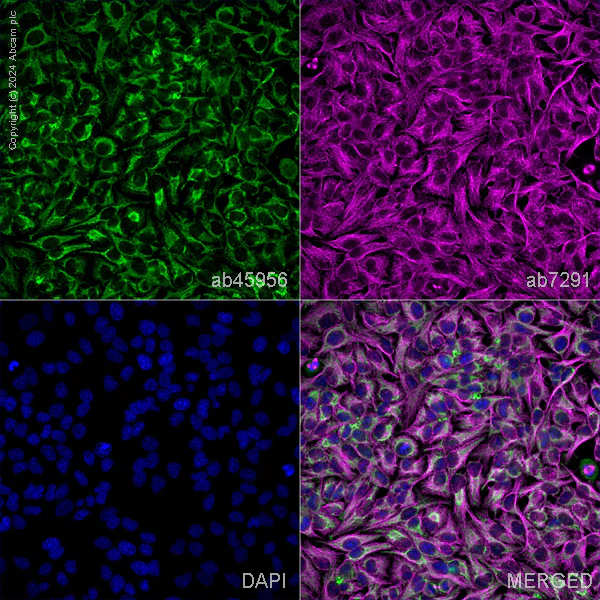 Immunocytochemistry/ Immunofluorescence - Anti-CPS1 antibody (AB45956)