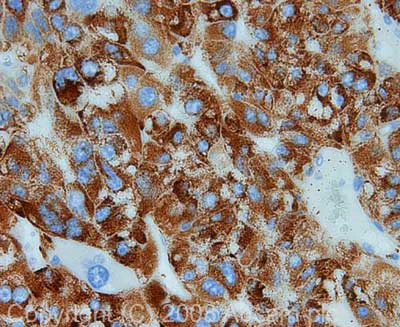 Immunohistochemistry (Formalin/PFA-fixed paraffin-embedded sections) - Anti-CPS1 antibody (AB45956)