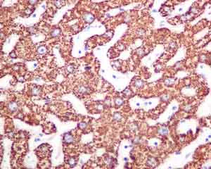 Immunohistochemistry (Formalin/PFA-fixed paraffin-embedded sections) - Anti-CPS1 antibody [EPR7493-29] (AB155083)