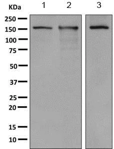 Western blot - Anti-CPS1 antibody [EPR7493-29] (AB155083)