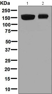Western blot - Anti-CPS1 antibody [EPR7494] (AB128942)