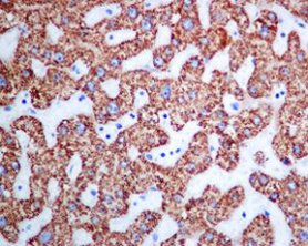 Immunohistochemistry (Formalin/PFA-fixed paraffin-embedded sections) - Anti-CPS1 antibody [EPR7494] - BSA and Azide free (AB248236), expandable thumbnail