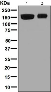 Western blot - Anti-CPS1 antibody [EPR7494] - BSA and Azide free (AB248236)