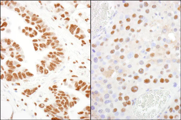 Immunohistochemistry (Formalin/PFA-fixed paraffin-embedded sections) - Anti-CPSF1 antibody (AB81552)