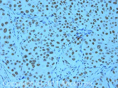 Immunohistochemistry (Formalin/PFA-fixed paraffin-embedded sections) - Anti-CPSF1 antibody (AB81552)