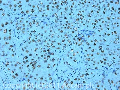 Immunohistochemistry (Formalin/PFA-fixed paraffin-embedded sections) - Anti-CPSF1 antibody (AB81552)