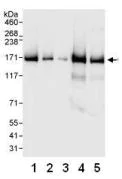 Western blot - Anti-CPSF1 antibody (AB81552)