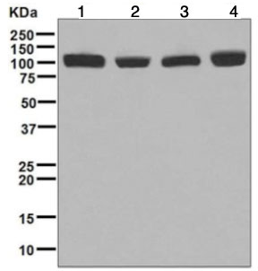 Western blot - Anti-CPSF2/CPSF100 antibody [EPR7599] - BSA and Azide free (AB248172)