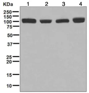 Western blot - Anti-CPSF2/CPSF100 antibody [EPR7599] - BSA and Azide free (AB248172)