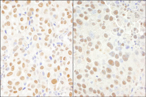Immunohistochemistry (Formalin/PFA-fixed paraffin-embedded sections) - Anti-CPSF6 antibody (AB99347)