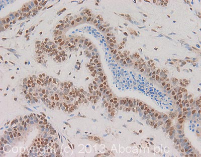 Immunohistochemistry (Formalin/PFA-fixed paraffin-embedded sections) - Anti-CPSF6 antibody (AB99347)