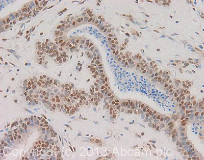Immunohistochemistry (Formalin/PFA-fixed paraffin-embedded sections) - Anti-CPSF6 antibody (AB99347)