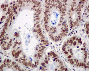 Immunohistochemistry (Formalin/PFA-fixed paraffin-embedded sections) - Anti-CPSF6 antibody [EPR12898] - BSA and Azide free (AB238933)