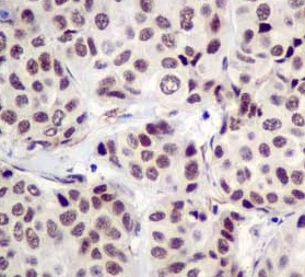 Immunohistochemistry (Formalin/PFA-fixed paraffin-embedded sections) - Anti-CPSF6 antibody [EPR12899] (AB181221), expandable thumbnail