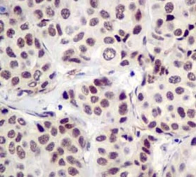 Immunohistochemistry (Formalin/PFA-fixed paraffin-embedded sections) - Anti-CPSF6 antibody [EPR12899] (AB181221)