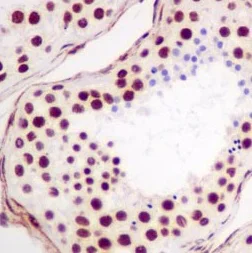 Immunohistochemistry (Formalin/PFA-fixed paraffin-embedded sections) - Anti-CPSF6 antibody [EPR12899] - BSA and Azide free (AB250437)