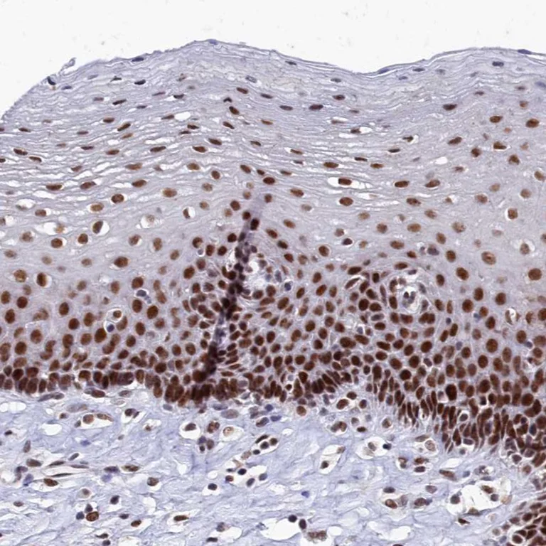 Immunohistochemistry (Formalin/PFA-fixed paraffin-embedded sections) - Anti-CPSF7 antibody (AB272634)