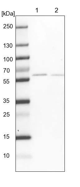 Western blot - Anti-CPSF7 antibody (AB272634)