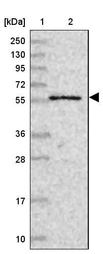 Western blot - Anti-CPSF7 antibody (AB272634)