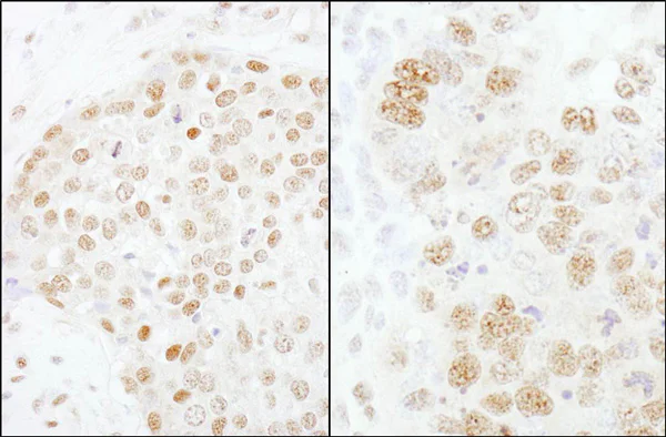 Immunohistochemistry (Formalin/PFA-fixed paraffin-embedded sections) - Anti-CPSF73 antibody (AB72295)