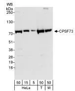 Western blot - Anti-CPSF73 antibody (AB72295)
