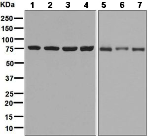 Western blot - Anti-CPSF73 antibody [EPR7468] - BSA and Azide free (AB248388), expandable thumbnail