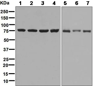 Western blot - Anti-CPSF73 antibody [EPR7468] - BSA and Azide free (AB248388)