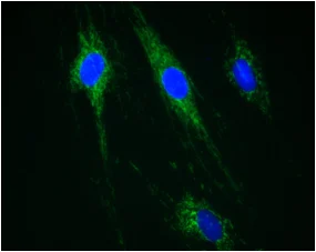 Immunocytochemistry/ Immunofluorescence - Anti-CPT1A antibody [8F6AE9] (AB128568)