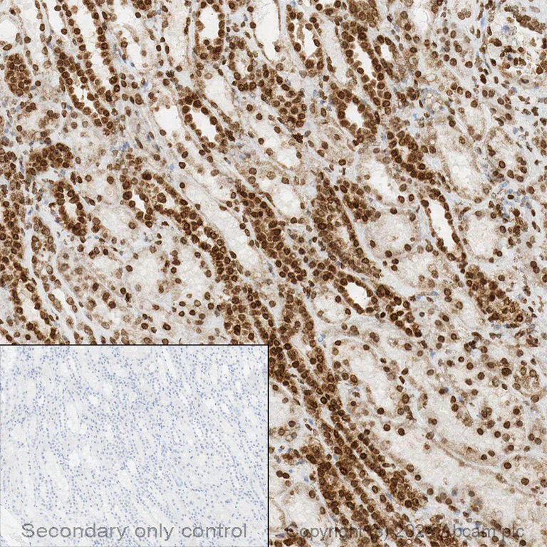 Immunohistochemistry (Formalin/PFA-fixed paraffin-embedded sections) - Anti-CPT1A antibody [8F6AE9] (AB128568)