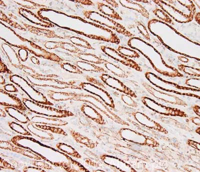 Immunohistochemistry (Formalin/PFA-fixed paraffin-embedded sections) - Anti-CPT1A antibody [8F6AE9] (AB128568)