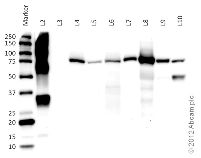 Western blot - Anti-CPT1A antibody [8F6AE9] (AB128568)