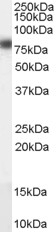 Western blot - Anti-CPT1A antibody (AB53532), expandable thumbnail
