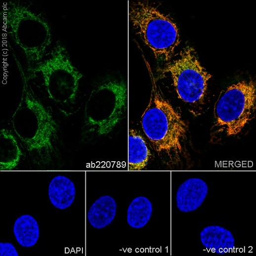 Immunocytochemistry/ Immunofluorescence - Anti-CPT1A antibody [EPR21843-71-1C] (AB220789), expandable thumbnail