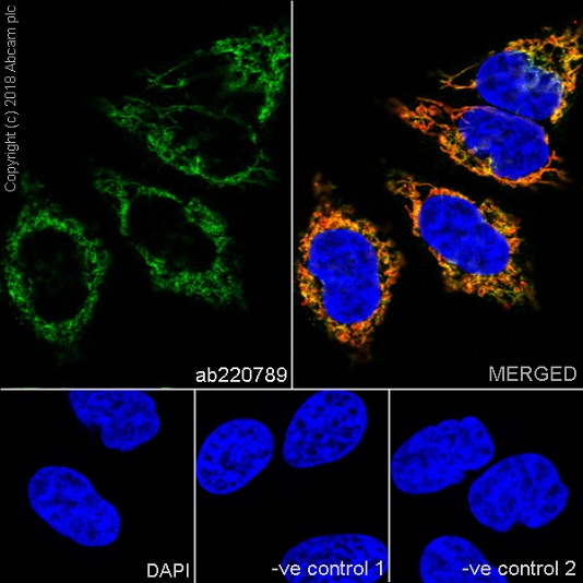 Immunocytochemistry/ Immunofluorescence - Anti-CPT1A antibody [EPR21843-71-1C] (ab220789), expandable thumbnail