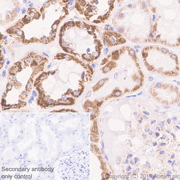 Immunohistochemistry (Formalin/PFA-fixed paraffin-embedded sections) - Anti-CPT1A antibody [EPR21843-71-1C] (AB220789), expandable thumbnail