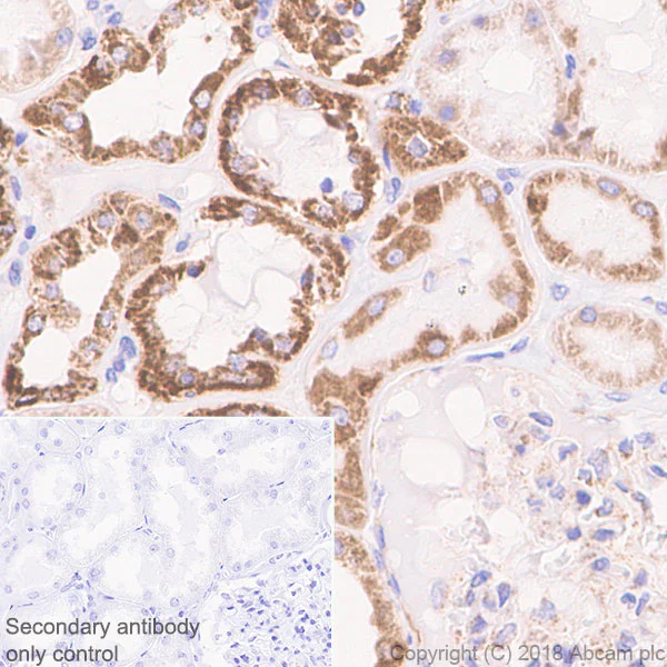 Immunohistochemistry (Formalin/PFA-fixed paraffin-embedded sections) - Anti-CPT1A antibody [EPR21843-71-1C] (AB220789)