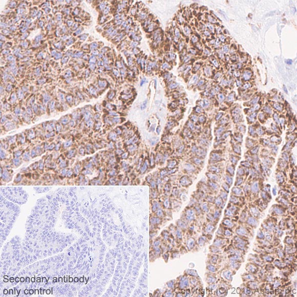 Immunohistochemistry (Formalin/PFA-fixed paraffin-embedded sections) - Anti-CPT1A antibody [EPR21843-71-1C] (ab220789), expandable thumbnail