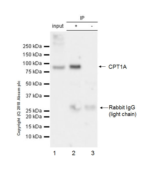 Immunoprecipitation - Anti-CPT1A antibody [EPR21843-71-1C] (AB220789), expandable thumbnail