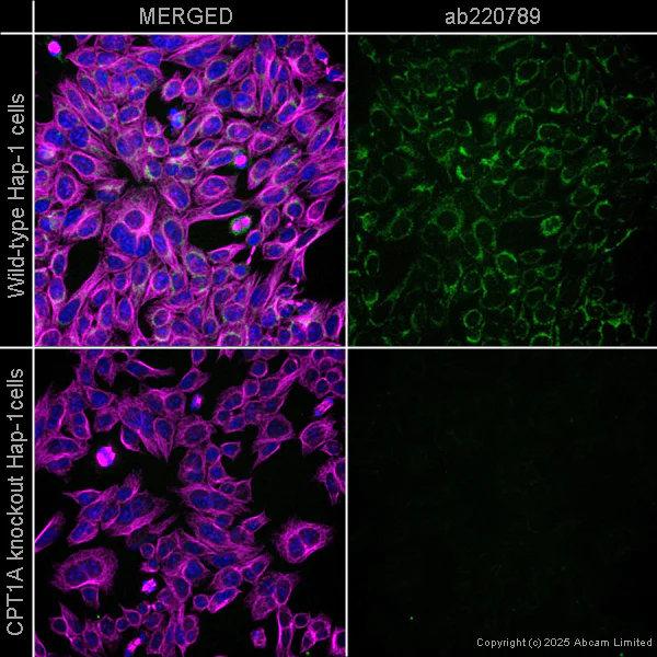 Immunocytochemistry/ Immunofluorescence - Anti-CPT1A antibody [EPR21843-71-1C] - BSA and Azide free (AB234906)